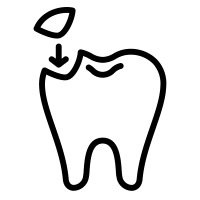 Composite Bonding