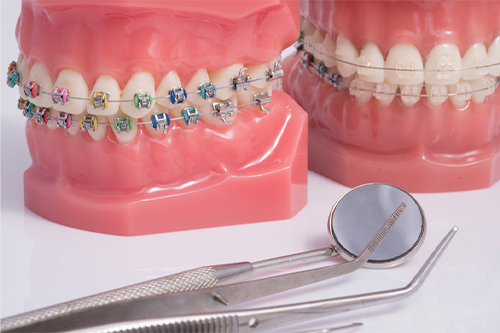 Orthodontics Treatment