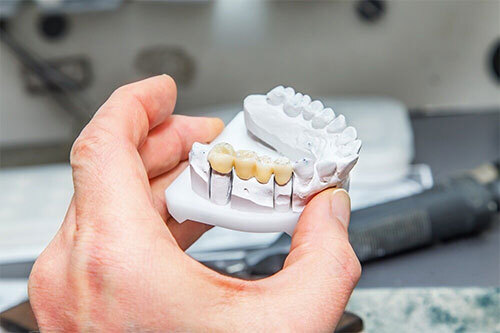 Dentures Treatment