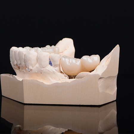 What Is Zirconia Crown?